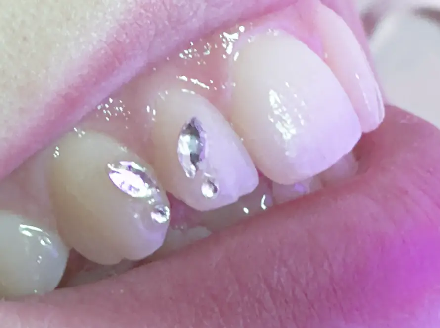Gemas Dentales